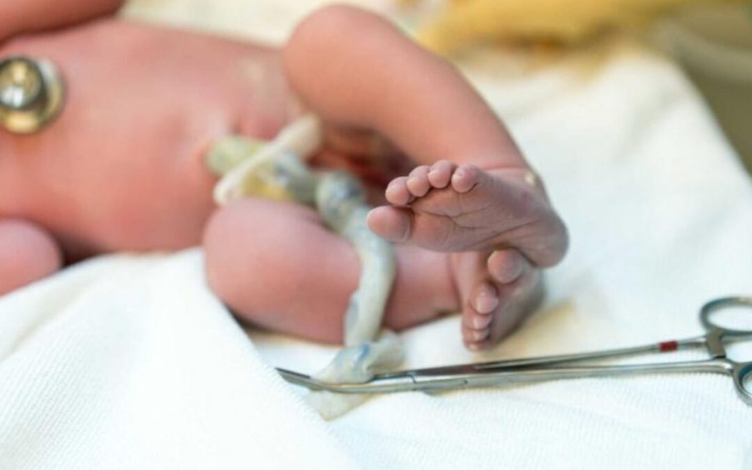 sangue do cordão umbilical - Recém nascido